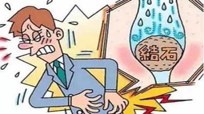 尿結石最快的排出方法